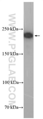 REST Antibody in Western Blot (WB)