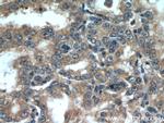 STK4/MST1 Antibody in Immunohistochemistry (Paraffin) (IHC (P))