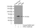 STK4/MST1 Antibody in Immunoprecipitation (IP)