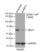 STK4/MST1 Antibody in Western Blot (WB)