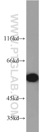 STK4/MST1 Antibody in Western Blot (WB)