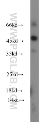 TBP Antibody in Western Blot (WB)