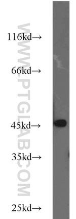 TBP Antibody in Western Blot (WB)