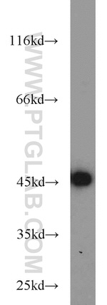 TBP Antibody in Western Blot (WB)