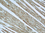 TNNI1 Antibody in Immunohistochemistry (Paraffin) (IHC (P))