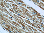 TNNI1 Antibody in Immunohistochemistry (Paraffin) (IHC (P))