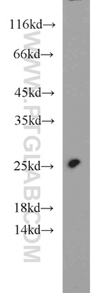 TNNI1 Antibody in Western Blot (WB)