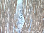 TNNI1 Antibody in Immunohistochemistry (Paraffin) (IHC (P))