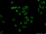 ASF1B Antibody in Immunocytochemistry (ICC/IF)