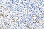 ASF1B Antibody in Immunohistochemistry (Paraffin) (IHC (P))