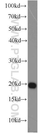 ASF1B Antibody in Western Blot (WB)