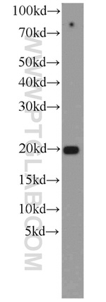 ASF1B Antibody in Western Blot (WB)