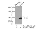 VAMP7/TI-VAMP Antibody in Immunoprecipitation (IP)