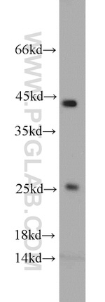 VAMP7/TI-VAMP Antibody in Western Blot (WB)