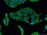 CACNA1D Antibody in Immunocytochemistry (ICC/IF)