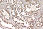 CREBBP Antibody in Immunohistochemistry (Paraffin) (IHC (P))