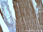 MYH7 Antibody in Immunohistochemistry (Paraffin) (IHC (P))