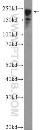 MYH6 Antibody in Western Blot (WB)