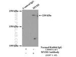 MYH3 Antibody in Immunoprecipitation (IP)