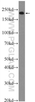 MYH3 Antibody in Western Blot (WB)