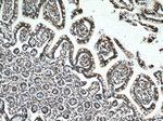 SAR1B Antibody in Immunohistochemistry (Paraffin) (IHC (P))