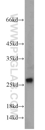 SAR1B Antibody in Western Blot (WB)