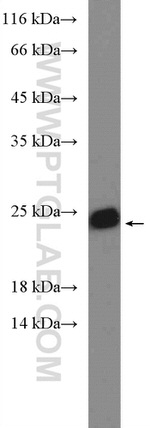 SAR1B Antibody in Western Blot (WB)