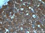 CCL24/Eotaxin 2 Antibody in Immunohistochemistry (Paraffin) (IHC (P))