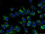 TGF-alpha Antibody in Immunocytochemistry (ICC/IF)