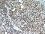 TGF-alpha Antibody in Immunohistochemistry (Paraffin) (IHC (P))