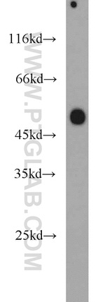 Phospho-TDP43 (Ser409, Ser410) Antibody in Western Blot (WB)