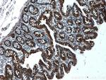 WNK4 Antibody in Immunohistochemistry (Paraffin) (IHC (P))