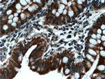 WNK4 Antibody in Immunohistochemistry (Paraffin) (IHC (P))