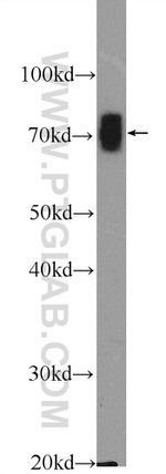 WNK4 Antibody in Western Blot (WB)