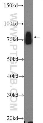 WNK4 Antibody in Western Blot (WB)