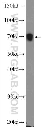 WNK4 Antibody in Western Blot (WB)