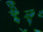 SMN Antibody in Immunocytochemistry (ICC/IF)