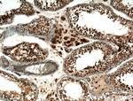 SMN Antibody in Immunohistochemistry (Paraffin) (IHC (P))