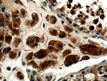 SMN Antibody in Immunohistochemistry (Paraffin) (IHC (P))