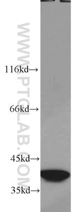 SMN Antibody in Western Blot (WB)