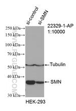 SMN Antibody in Western Blot (WB)