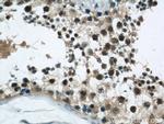 RCC1 Antibody in Immunohistochemistry (Paraffin) (IHC (P))