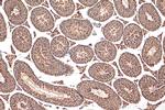 RCC1 Antibody in Immunohistochemistry (Paraffin) (IHC (P))