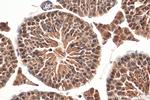 RCC1 Antibody in Immunohistochemistry (Paraffin) (IHC (P))