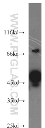 RCC1 Antibody in Western Blot (WB)