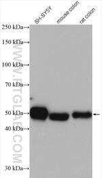 RCC1 Antibody in Western Blot (WB)