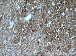 P glycoprotein Antibody in Immunohistochemistry (Paraffin) (IHC (P))