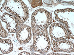 TCF4 Antibody in Immunohistochemistry (Paraffin) (IHC (P))