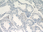 TCF4 Antibody in Immunohistochemistry (Paraffin) (IHC (P))