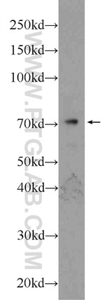 TCF4 Antibody in Western Blot (WB)